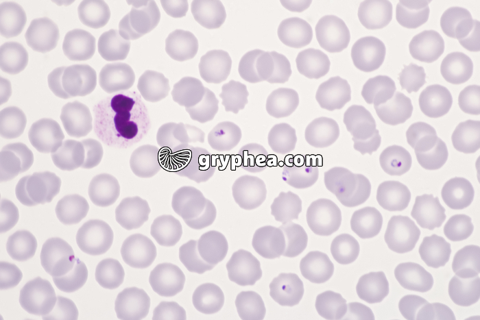 Plasmodium falciparum - agent du paludisme x400 - gryphea.org